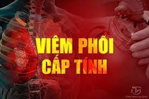 Viêm phổi cấp và những điều bạn cần biết về căn bệnh này